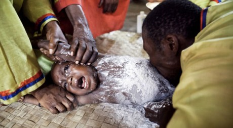 Un bébé recouvert de talc dans le «bloc chirurgical» pour être désenvouté. © Gwenn Dubourthoumieu. Tous droits réservés
