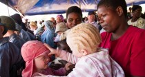 Au Malawi, les Albinos sont tués pour leurs os